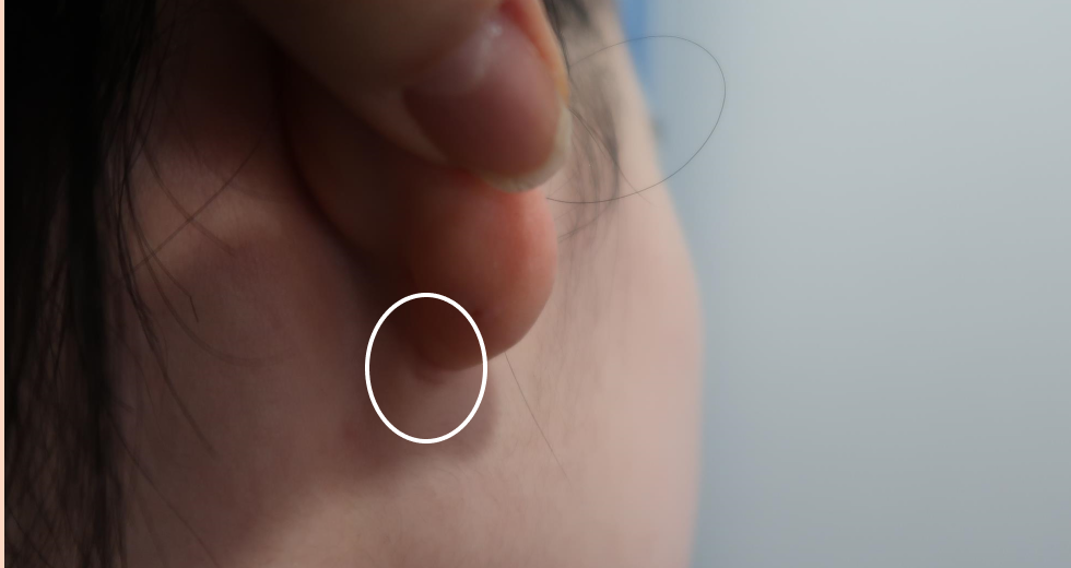 Line Culture: Between earlobe creases