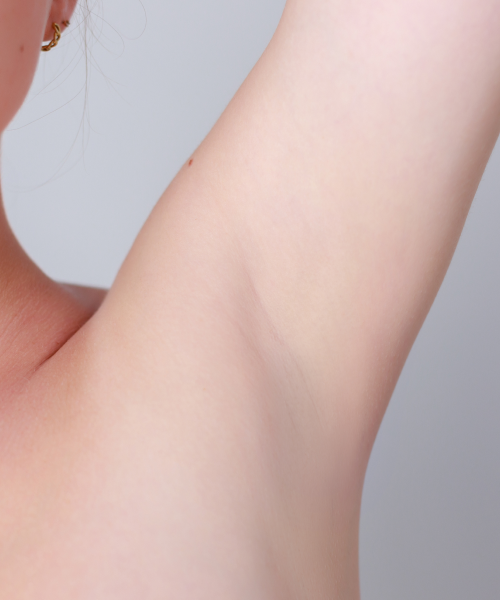 Armpit crease