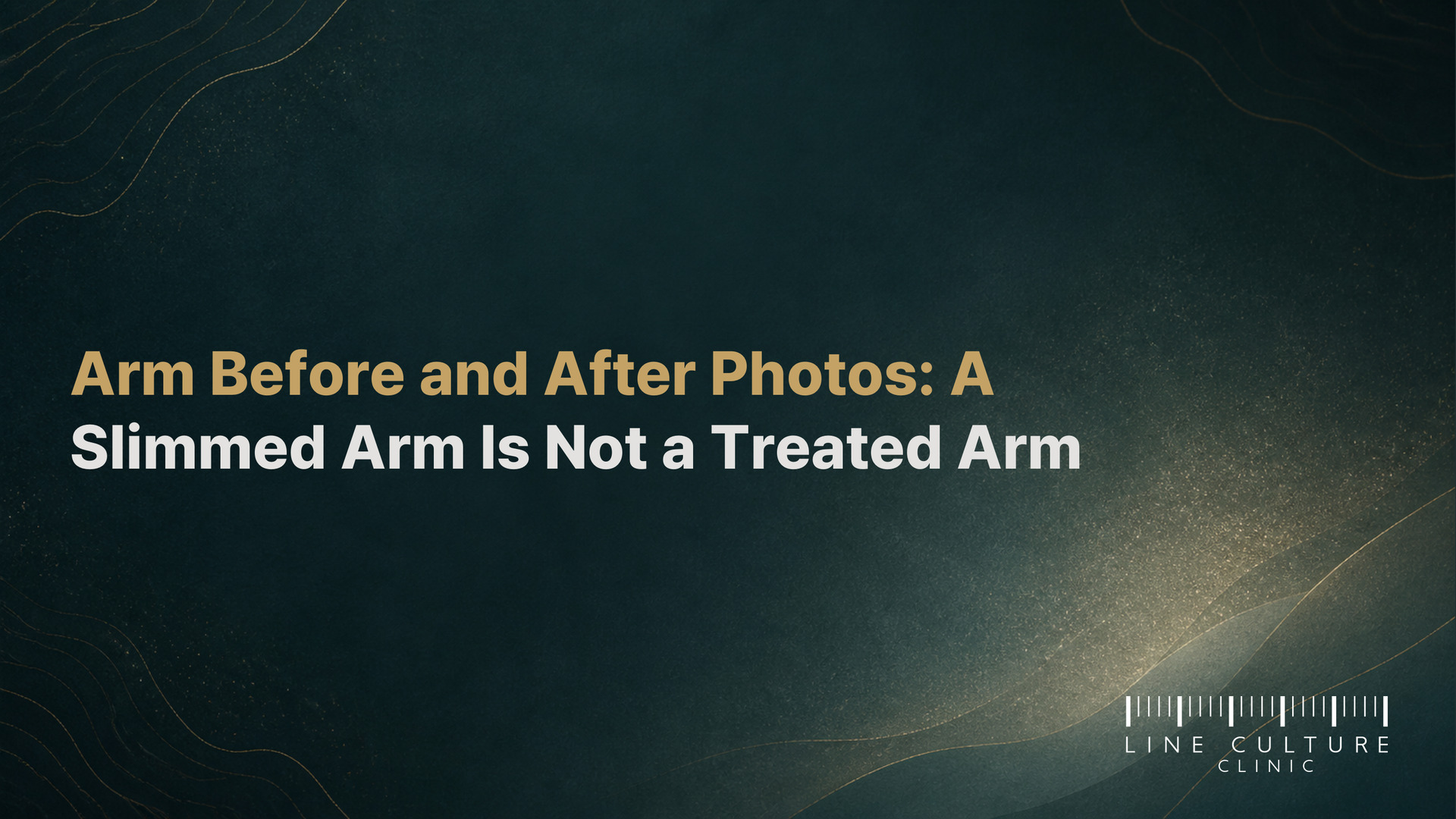 Arm Before and After Photos: A Slimmed Arm Is Not a Treated Arm - Line Culture Clinic