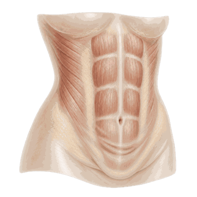 Low-elasticity type — diagram of thin fat but loose, folded lower-belly skin