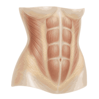 Visceral type — diagram of a thin subcutaneous layer with the abdominal muscles showing through