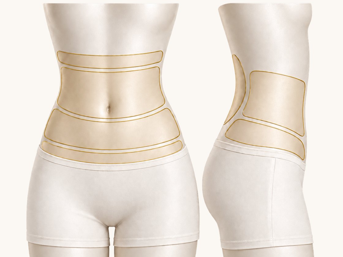 Diagram of abdomen liposuction areas, front and side views