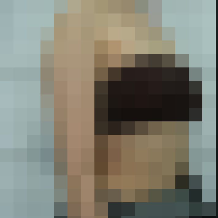 복부 상체 지방흡입 수술 전